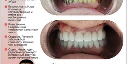 Лечение зубов в Китае, без страха и боли всего за 4 дня
